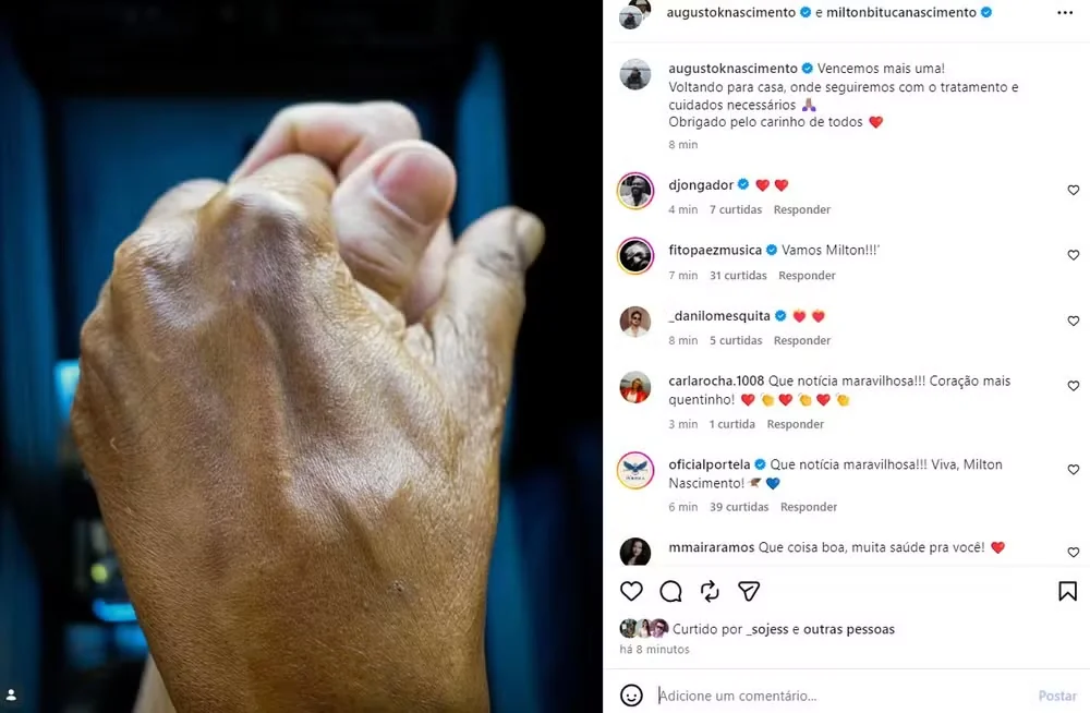 Milton Nascimento recebe alta após pneumonia e segue recuperação em casa