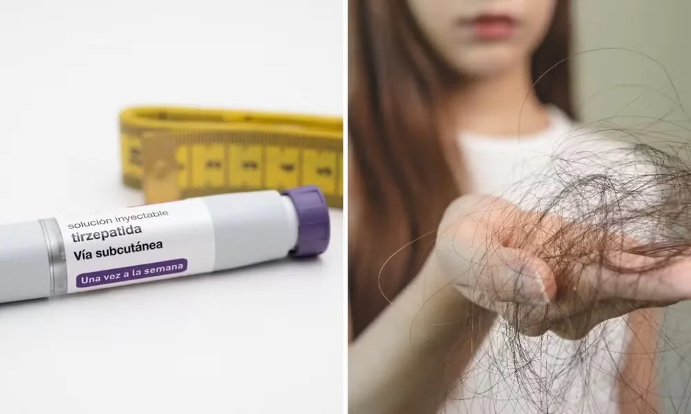 Estudo associa canetas emagrecedoras a maior risco de queda de cabelo e explica como prevenir