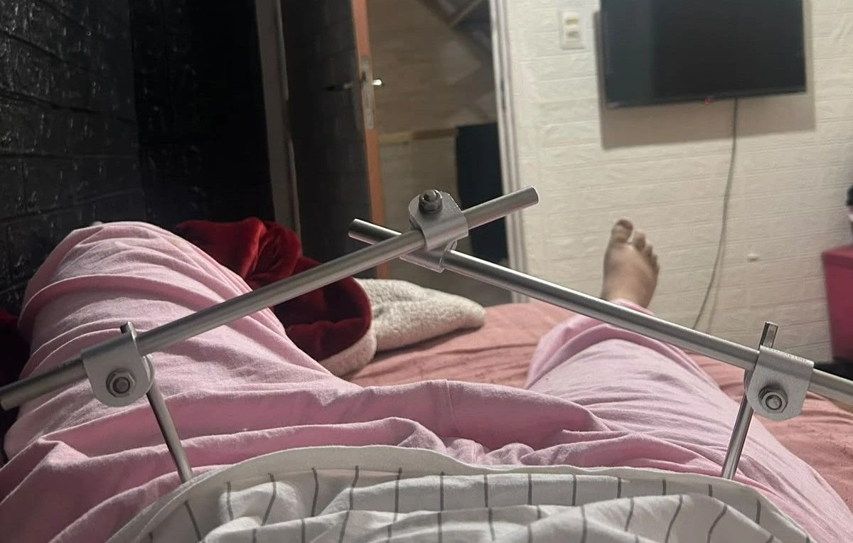 Paciente relata espera de 18 dias por cirurgia após fechamento de hospital em BH