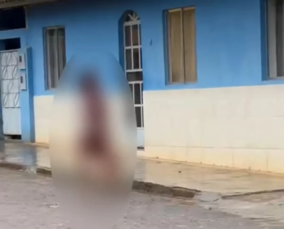 Mulher fica gravemente ferida após ataque com facão em MG