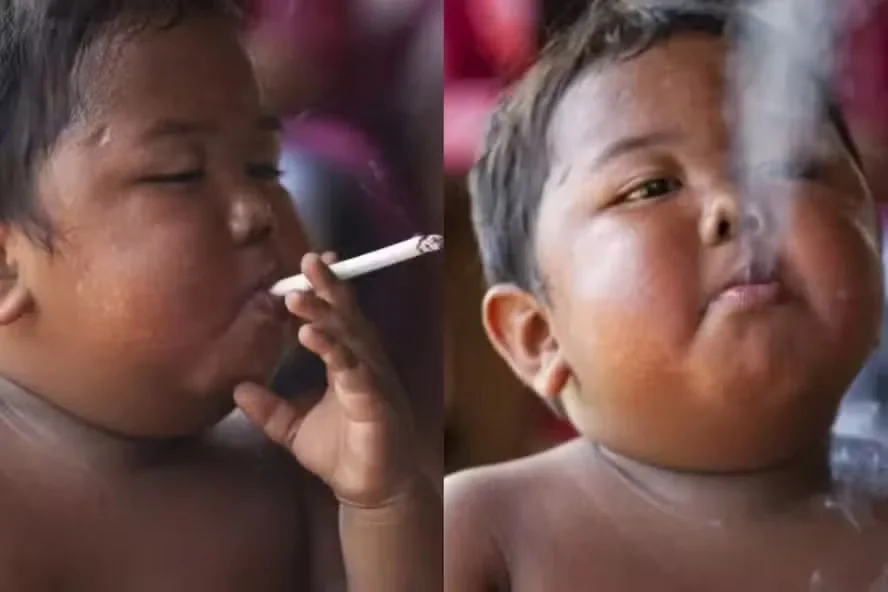 Lembra dele? Veja como está o menino que fumava 40 cigarros por dia