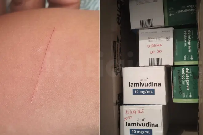 Menina de 4 anos inicia tratamento contra HIV após ser ferida por colega em escola de Sete Lagoas
