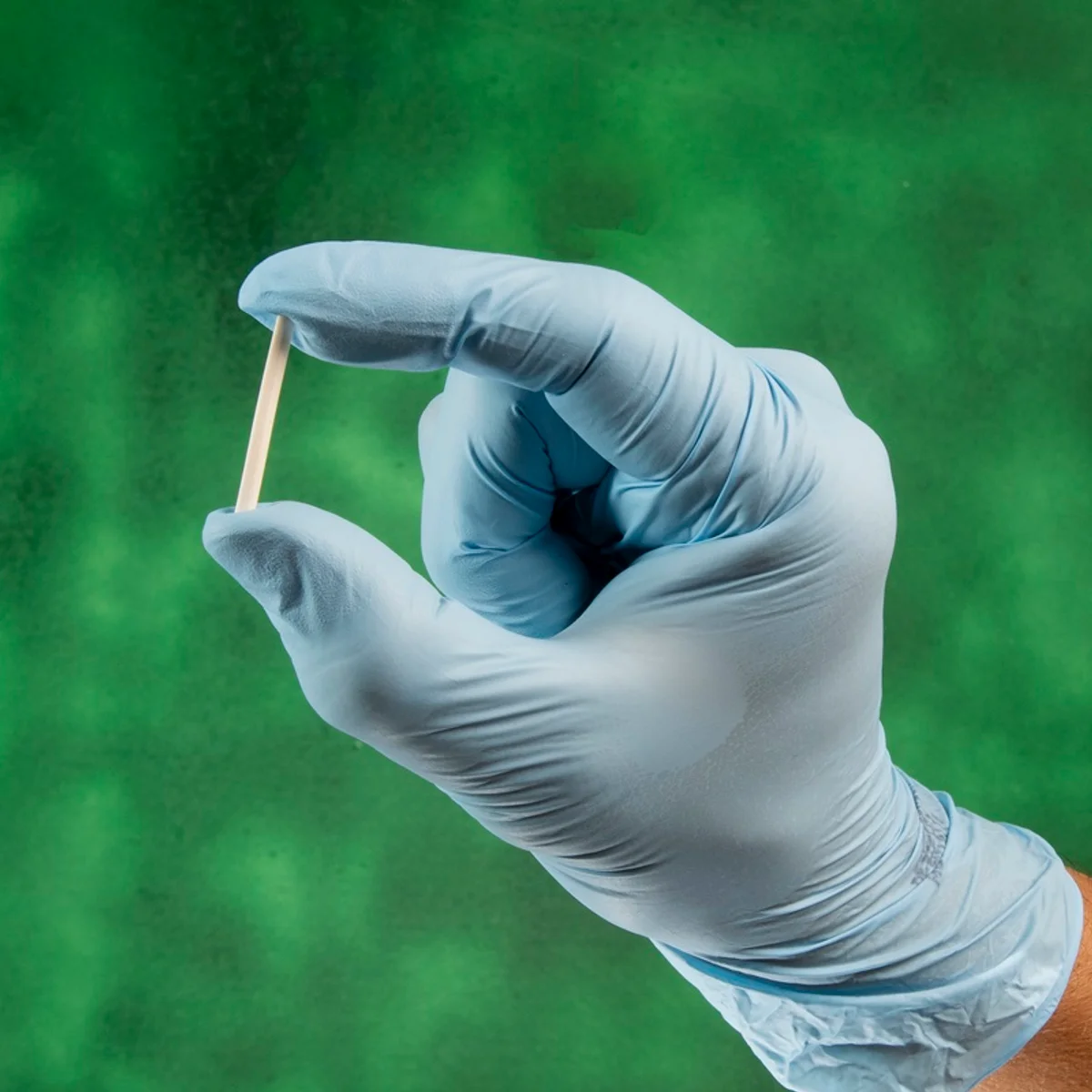 SUS oferece implante contraceptivo gratuitamente em condições previstas pelo Ministério da Saúde