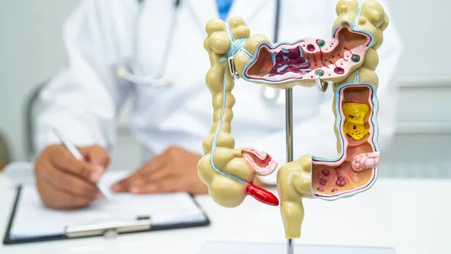 Doença inflamatória intestinal cresce cinco vezes no Brasil em 13 anos