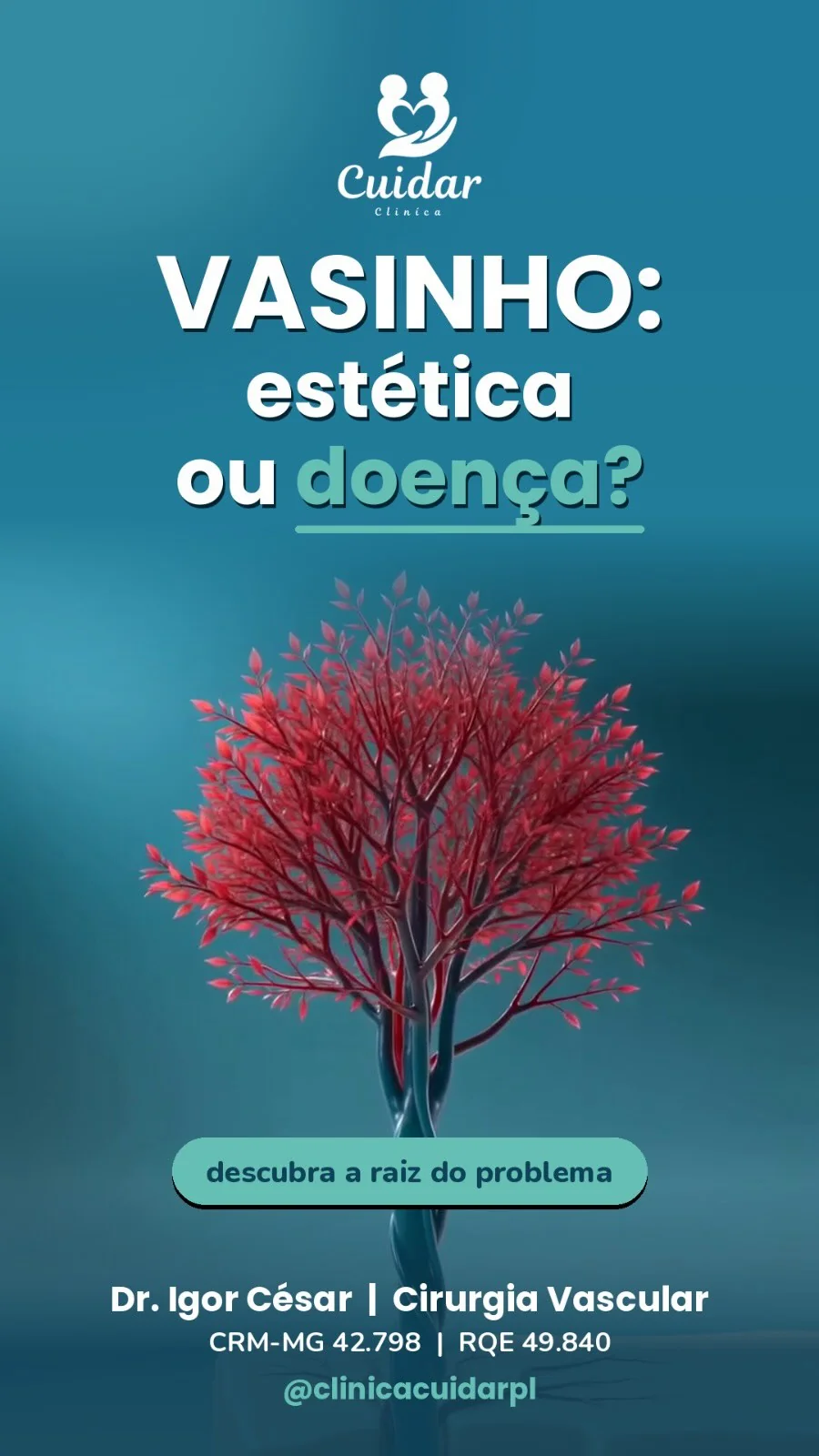 Vasinhos nas pernas são apenas uma questão estética ou podem indicar um problema de saúde?
