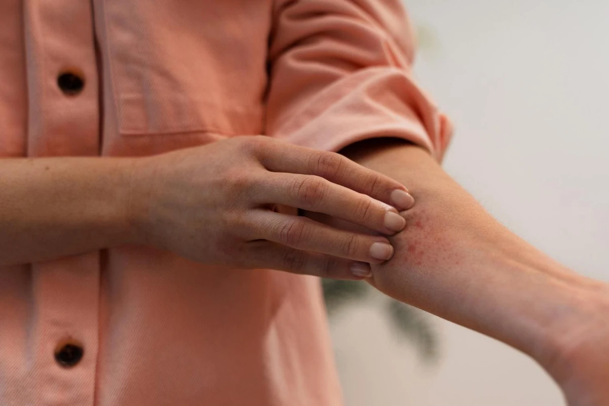 Perfume e cigarro podem causar alergia? Médica explica quando o cheiro vira gatilho para crises
