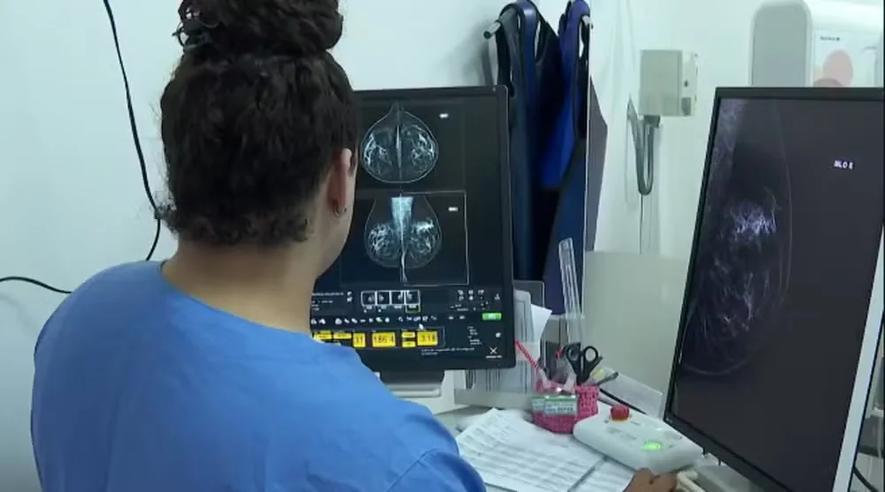 Minas Gerais lança ferramenta que avisa mulheres sobre a hora de fazer mamografia