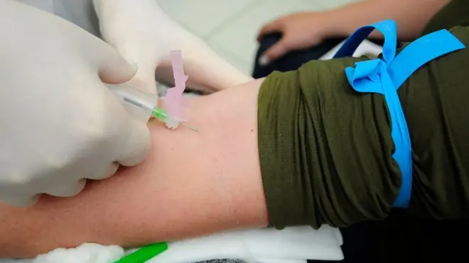 Estudo questiona jejum de 12 horas para exames de sangue e aponta exceções