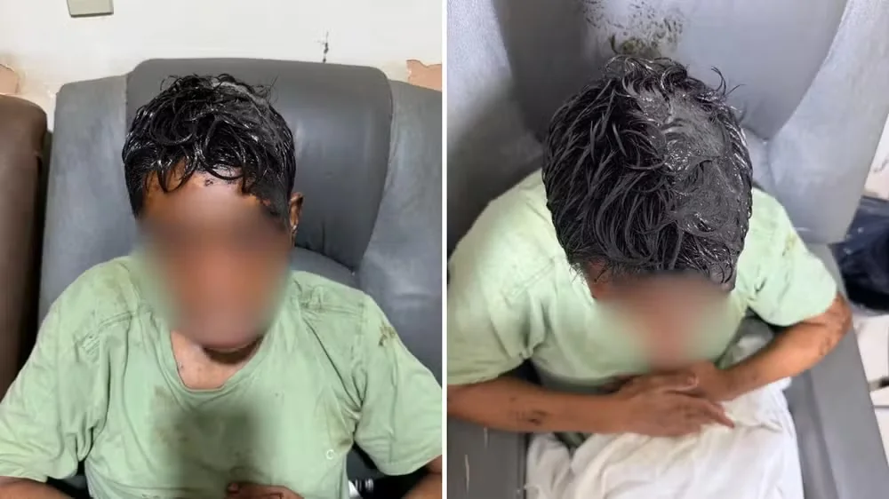 Homem com deficiência intelectual tem cabelo raspado após voltar para casa coberto de óleo diesel