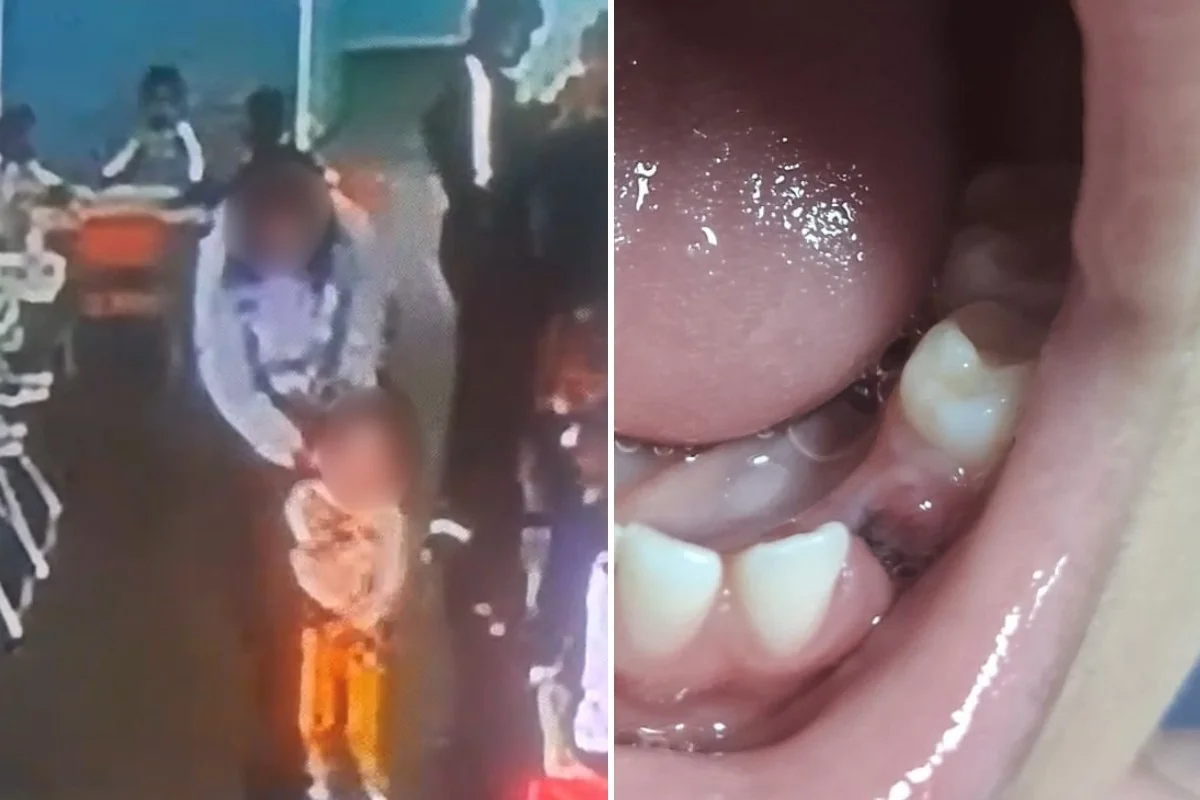 Família denuncia professora após criança de 3 anos perder dente em escola